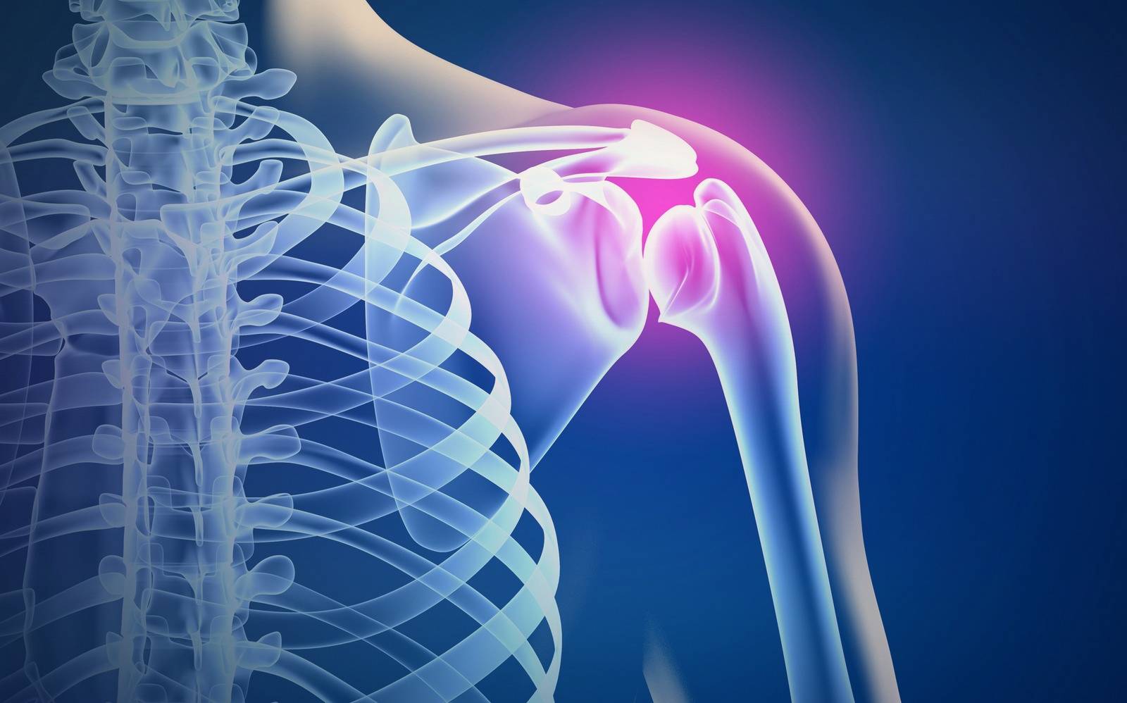 Артроз плечевого сустава симптомы и лечение